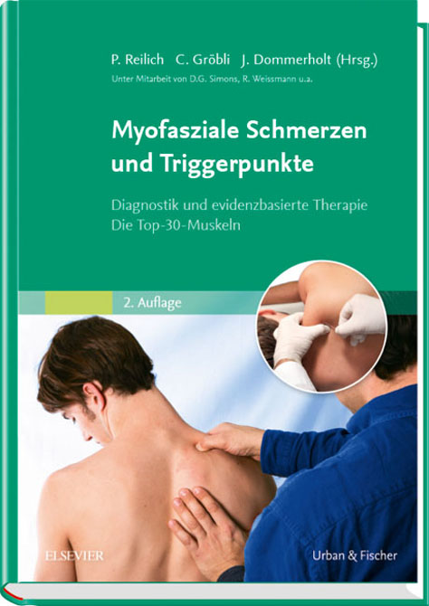 Myofasziale Schmerzen und Triggerpunkte