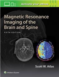 Cover Magnetic Resonance Imaging of the Brain and Spine