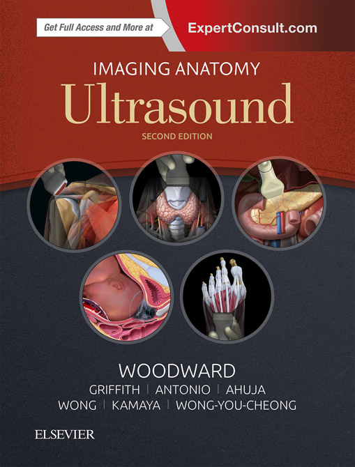 Imaging Anatomy: Ultrasound