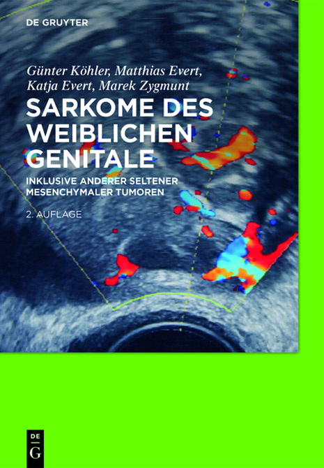 Sarkome des weiblichen Genitale