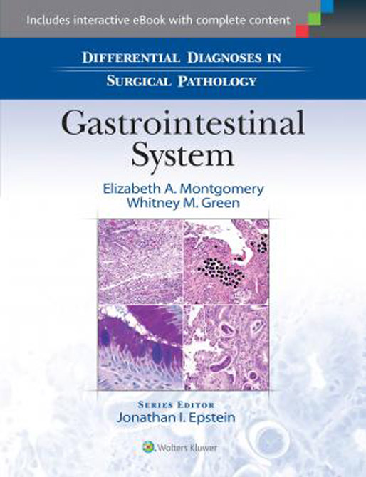 Differential Diagnoses in Surgical Pathology: Gastrointestinal Tract