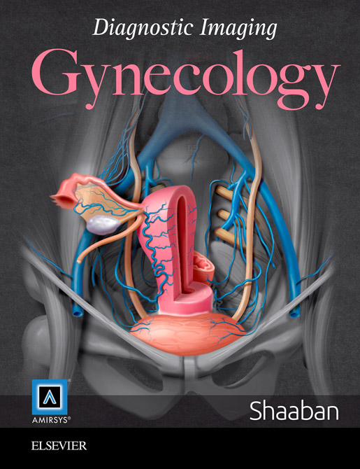 Diagnostic Imaging: Gynecology