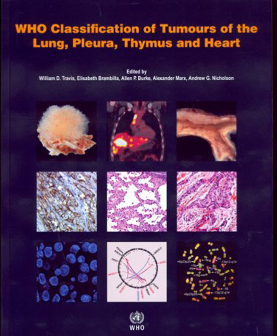 WHO Classification of Tumours.Tumours of the Lung, Pleura, Thymus and Heart
