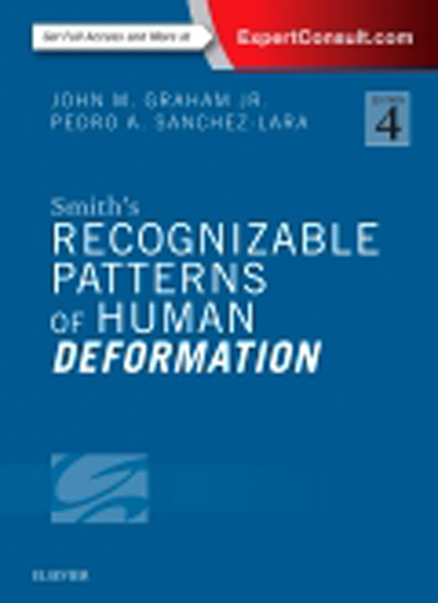 Smith's Recognizable Patterns of Human Malformation