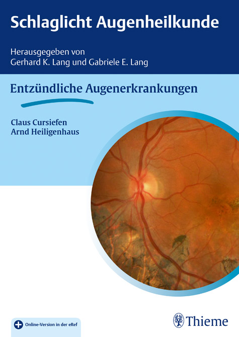 Schlaglicht Augenheilkunde: Entzündliche Augenerkrankungen