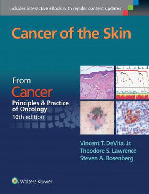 Cancer of the Skin