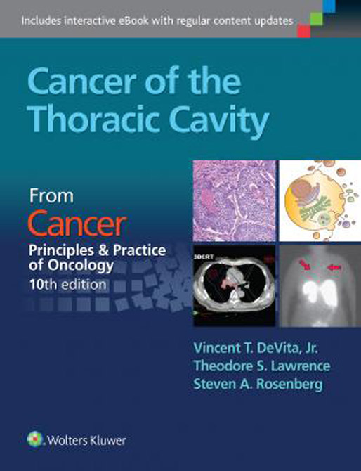 Cancer of the Thoracic Cavity