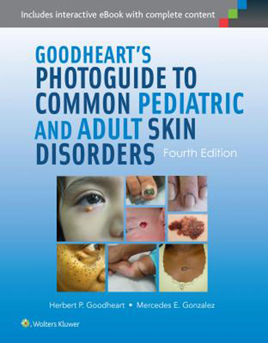 Goodheart's Photoguide of Common Skin Disorders