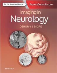 Cover Imaging in Neurology