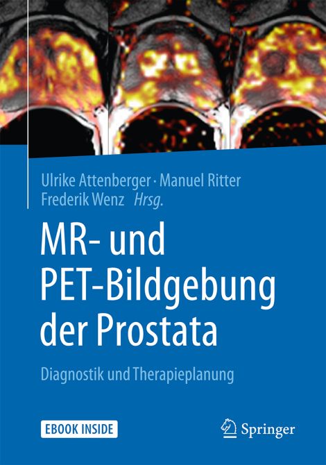 MR- und PET-Bildgebung der Prostata