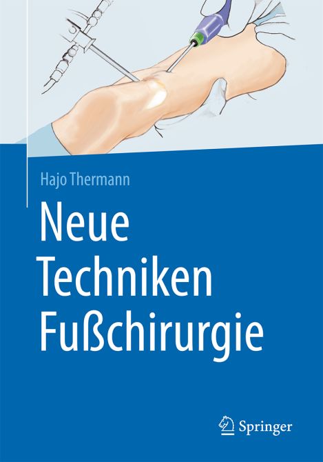 Neue Techniken Fußchirurgie