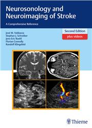 Cover Neurosonology and Neuroimaging of Stroke