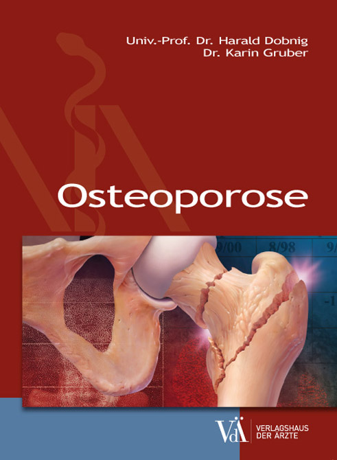 Osteoporose