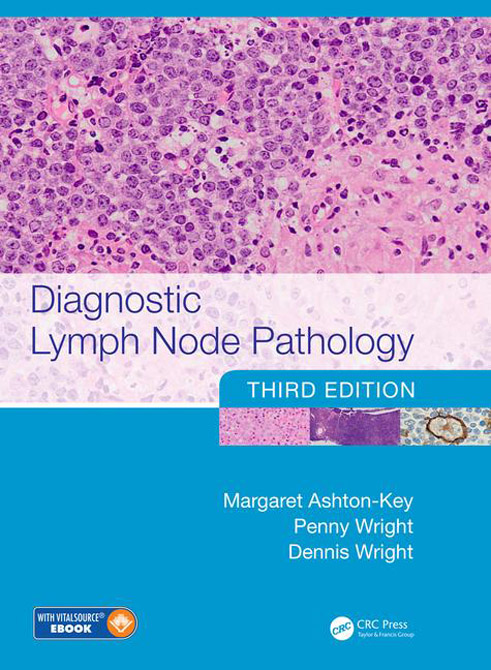 Diagnostic Lymph Node Pathology