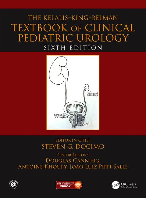 The Kelalis--King--Belman Textbook of Clinical Pediatric Urology