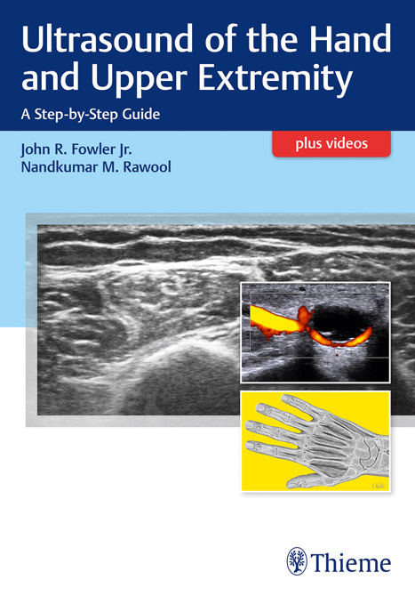 Ultrasound Techniques in the Hand and Upper Limb