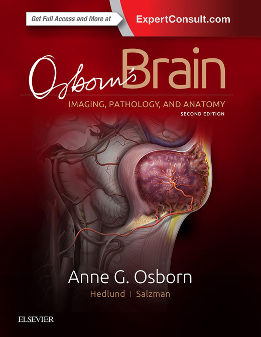 Osborn’s Brain - Imaging, Pathology, and Anatomy