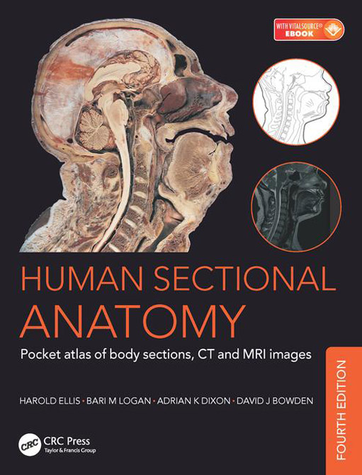 Human Sectional Anatomy: Pocket Atlas of Body Sections, CT and MRI Images