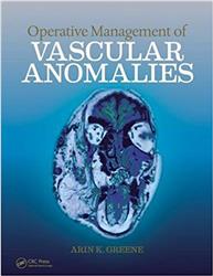 Cover Operative Management of Vascular Anomalies