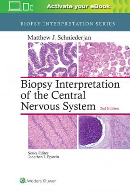 Biopsy Interpretation of the Central Nervous System