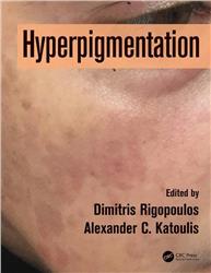 Cover Hyperpigmentation