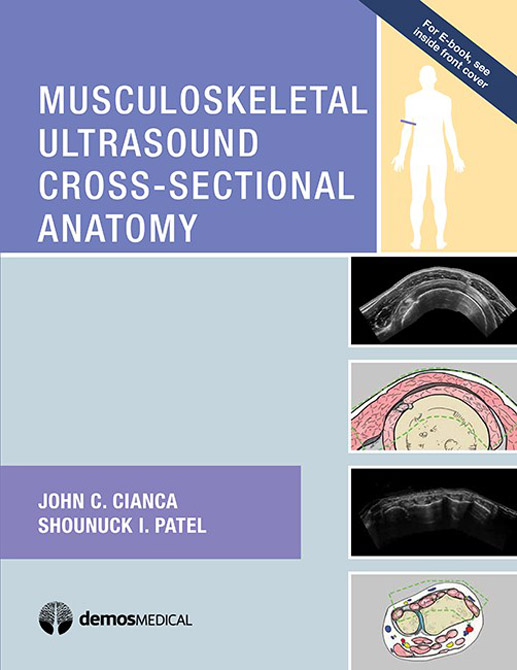 Musculoskeletal Ultrasound Cross-Sectional Anatomy