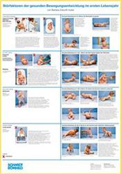 Cover Störfaktoren der gesunden Bewegungsentwicklung im ersten Lebensjahr - Plakat