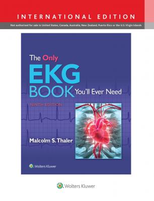 The Only EKG Book You'll Ever Need