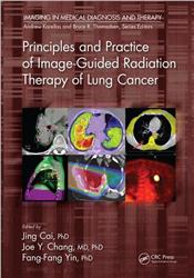 Cover Principles and Practice of Image-Guided Radiation Therapy of Lung Cancer