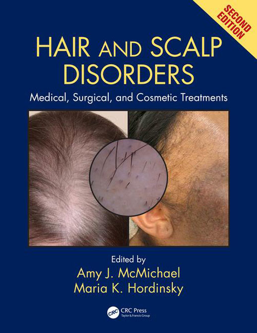 Hair and Scalp Disorders