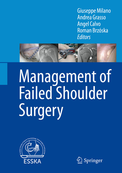 Management of Failed Shoulder Surgery