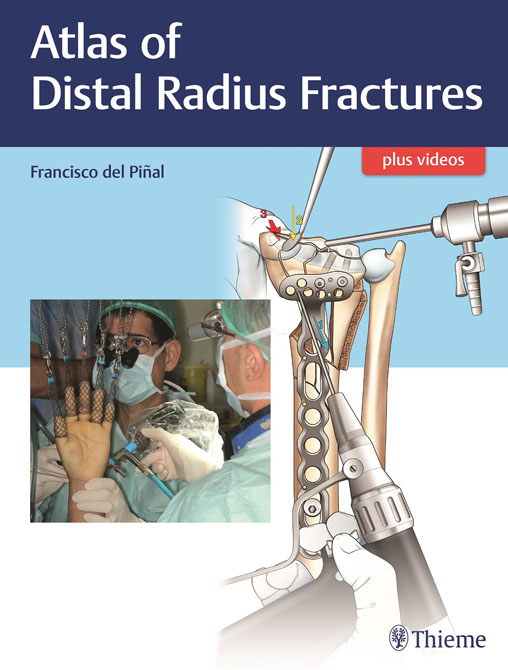 Atlas of Distal Radius Fractures