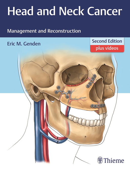 Head and Neck Cancer