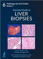 Cover Survival Guide to Liver Biopsies