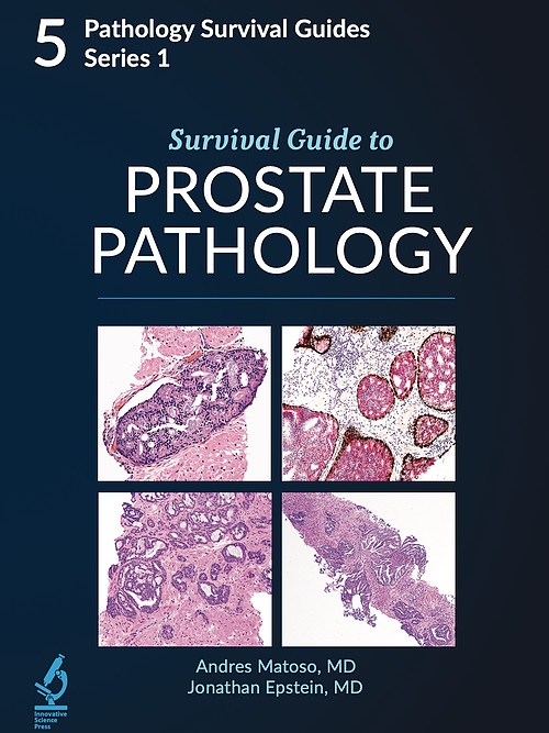 Survival Guide to Prostate Pathology