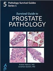 Cover Survival Guide to Prostate Pathology