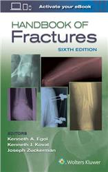 Cover Handbook of Fractures