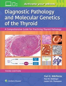 Diagnostic Pathology and Molecular Genetics of the Thyroid