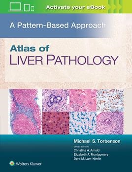 Atlas of the Liver Pathology: A Pattern Based Approach