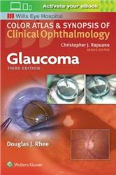 Cover Glaucoma