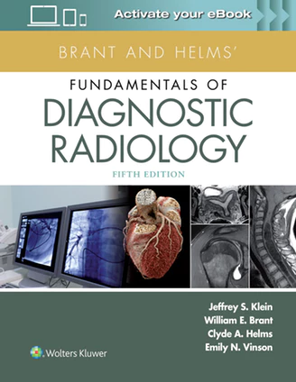 Brant and Helms Fundamentals of Diagnostic Radiology - 1 Vol.