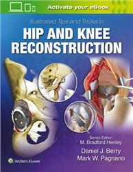 Cover Illustrated Tips and Tricks in Hip and Knee Reconstructive and Replacement Surgery