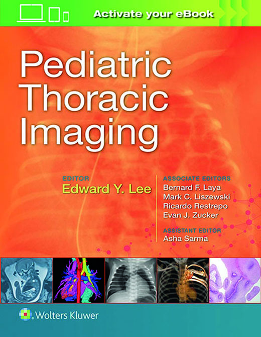 Pediatric Thoracic Imaging