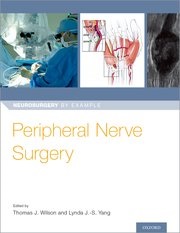 Peripheral Nerve Neurosurgery