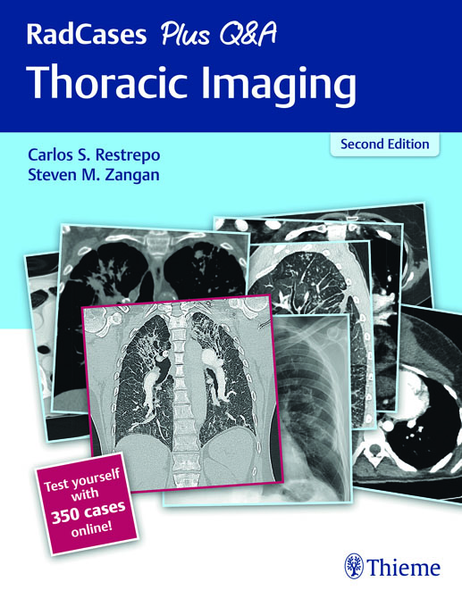 Thoracic Imaging - RadCases Plus Q&A