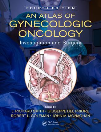 An Atlas of Gynecologic Oncology