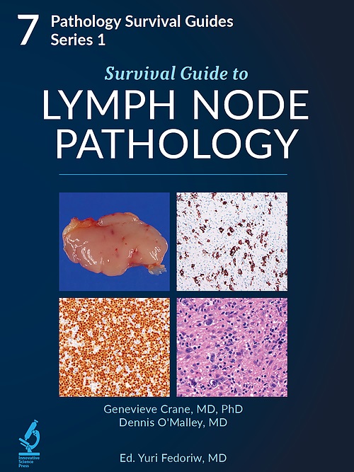 Survival Guide to Lymph Node Pathology