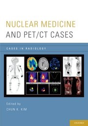 Nuclear Medicine and Pet/ CT Cases