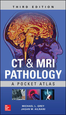 CT & MRI Pathology: A Pocket Atlas