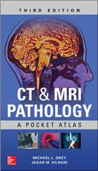 Cover CT & MRI Pathology: A Pocket Atlas